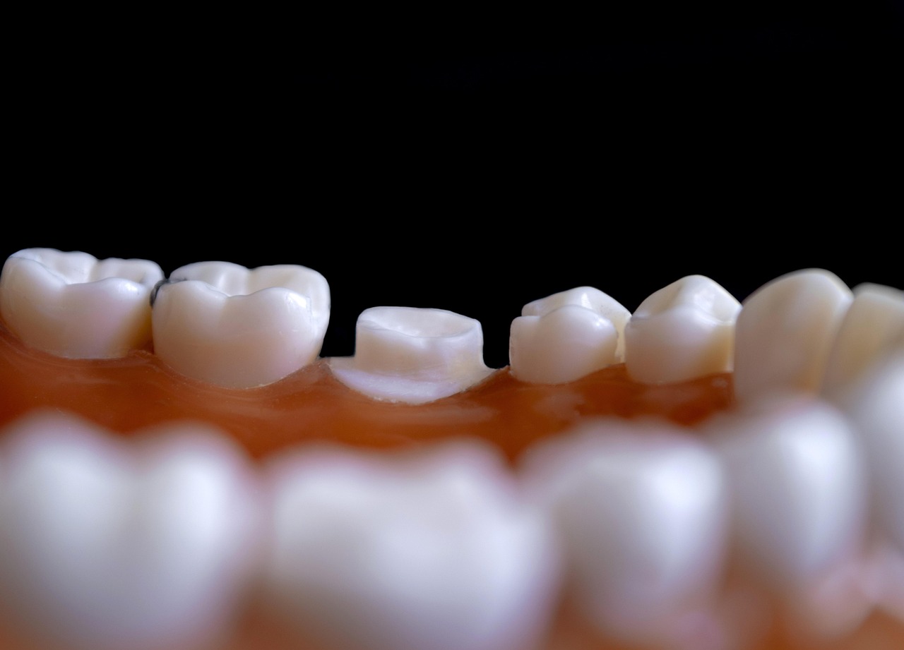 odontology, tooth, hygiene, treatment, dentist, orthodontics, odontology, odontology, tooth, tooth, tooth, tooth, tooth, dentist, dentist, dentist, dentist, dentist, orthodontics